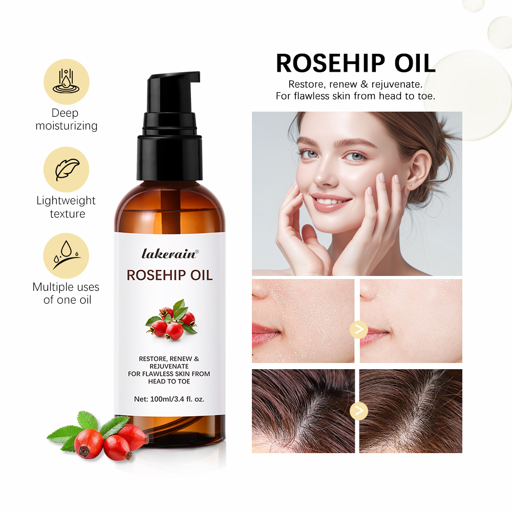 Face Oil Rosehip - 다기능 보습 로즈힙 에센셜 오일, 주름