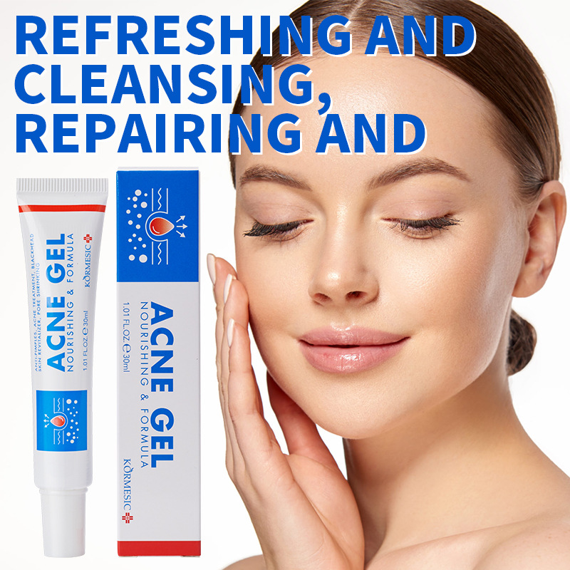 Face Moisturizer - 30g 여드름 제거 젤, 깊은 클렌징