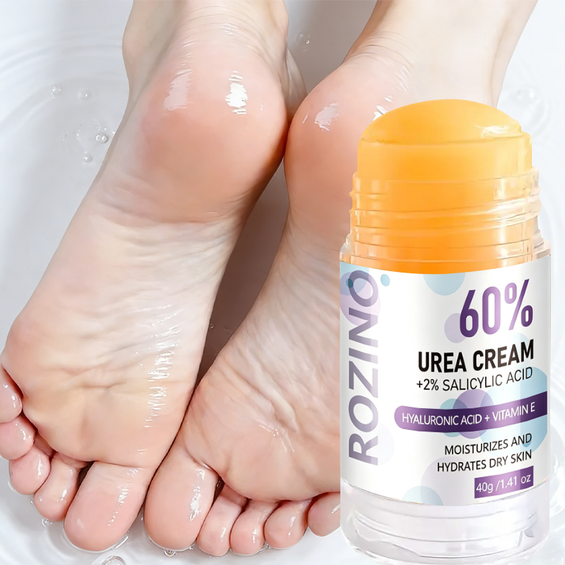 극심한 건조함과 갈라짐을 예방하는 크림, 건조하고 갈라 - Urea Foot Cream 리뷰 및 가격
