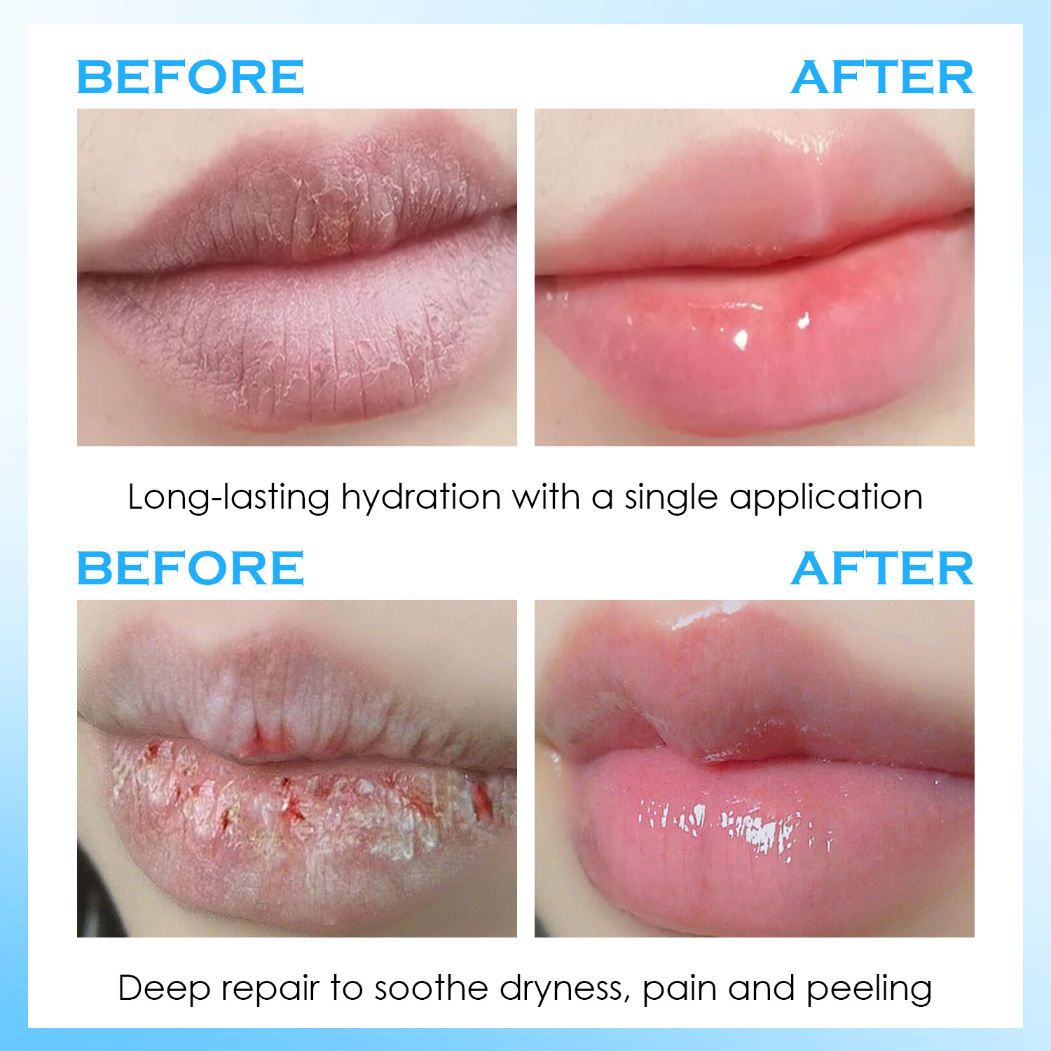 립 세럼, 보습 밤, 수분 공급, 입술 개선 트리트먼트 - Lip Balm 리뷰 및 가격