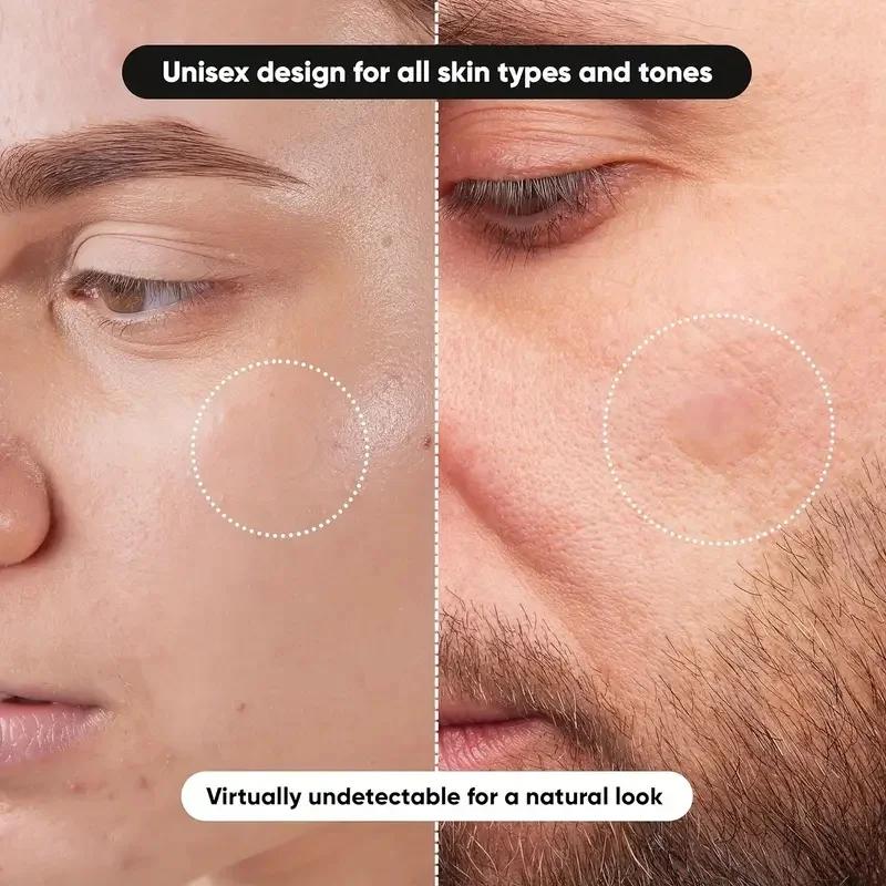 360개/박스 여드름 패치 - 무알콜, 여드름 분비물을 - Face Oil 리뷰 및 가격
