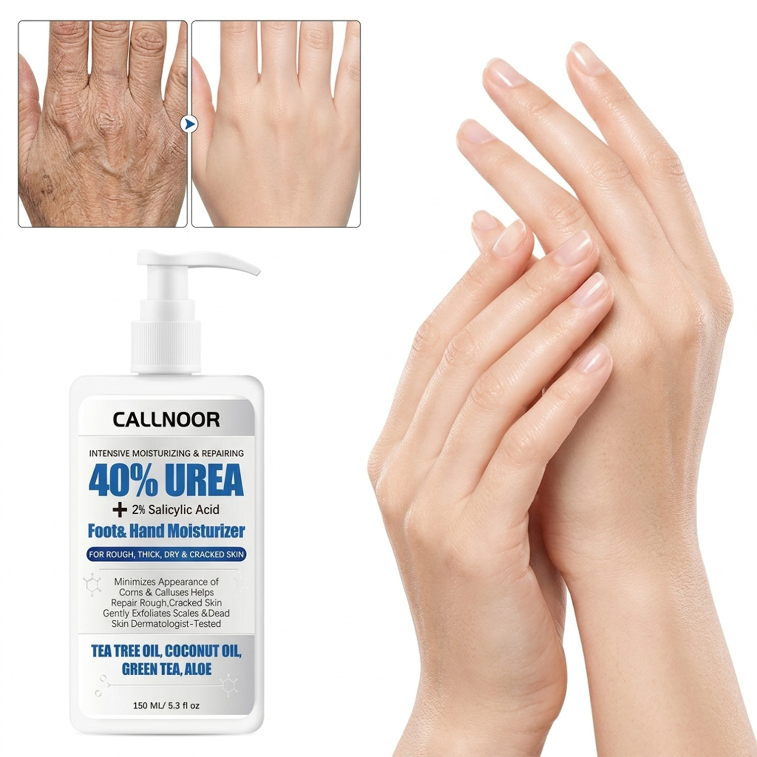 0% 우레아 핸드 풋 크림 2% 살리실산 모이스처라이저 - Urea Foot Cream 리뷰 및 가격