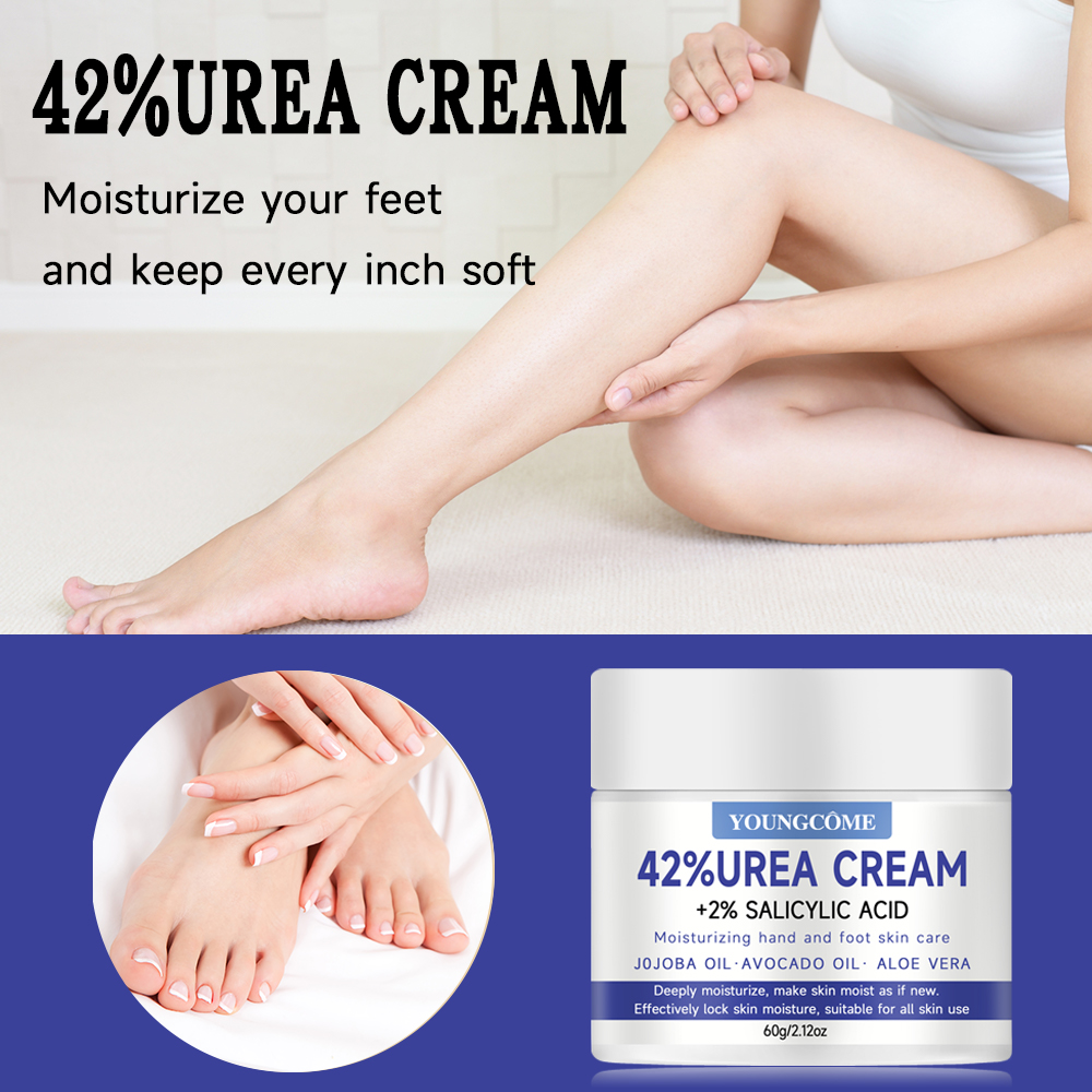 YOUNGCOME 42% 요소 크림 및 2% 살리실산  - Urea Foot Cream 리뷰 및 가격