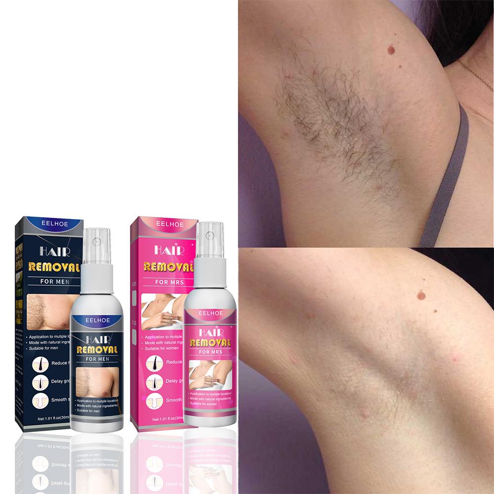 1/2PCS 여성을위한 슈퍼 자연 무통 영구 헤어 리무 - Body Lotion 리뷰 및 가격